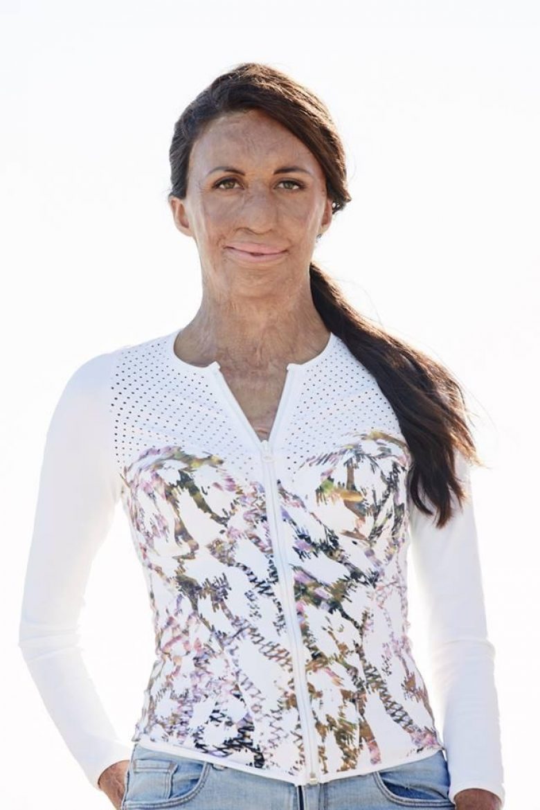 Turia Pitt